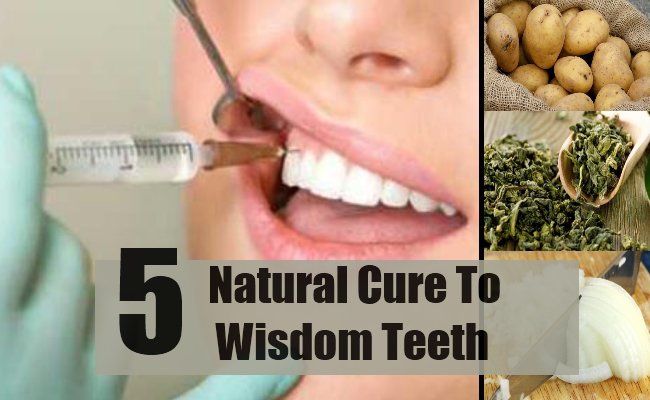 5 remèdes naturels simples pour dents de sagesse
