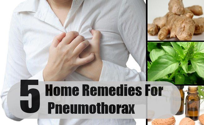 Top 5 des remèdes maison pour pneumothorax