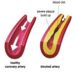 Élasticité dans les artères