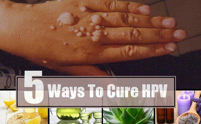 5 façons de guérir le VPH