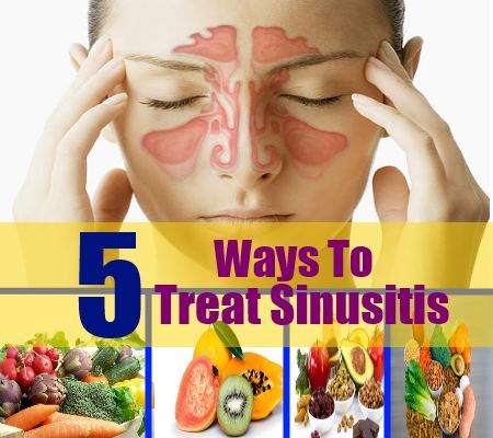 5 façons de traiter la sinusite avec des vitamines