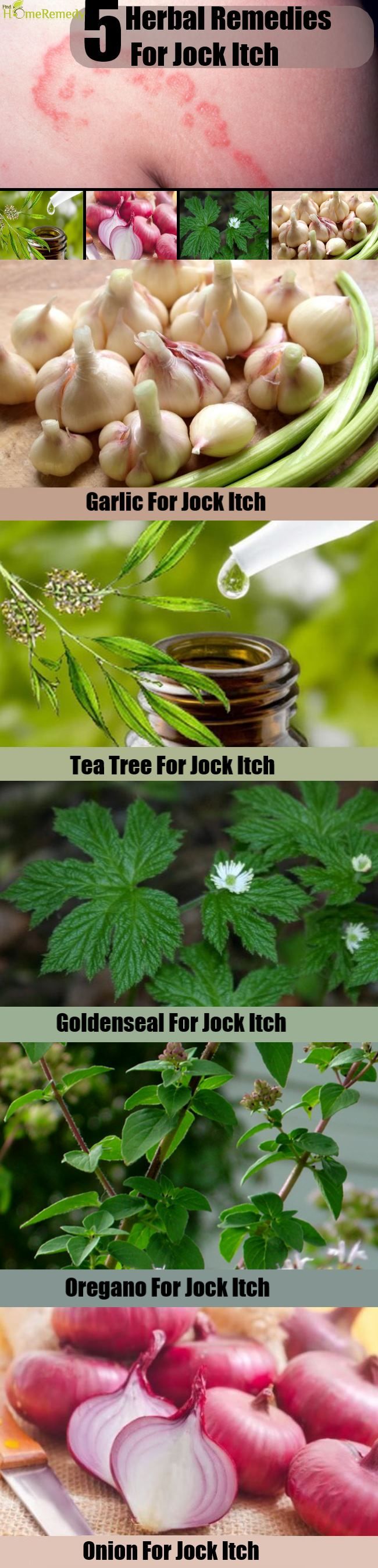 5 Remèdes naturels pour Jock Itch