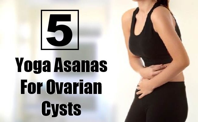 5 postures de yoga pour les kystes de l'ovaire