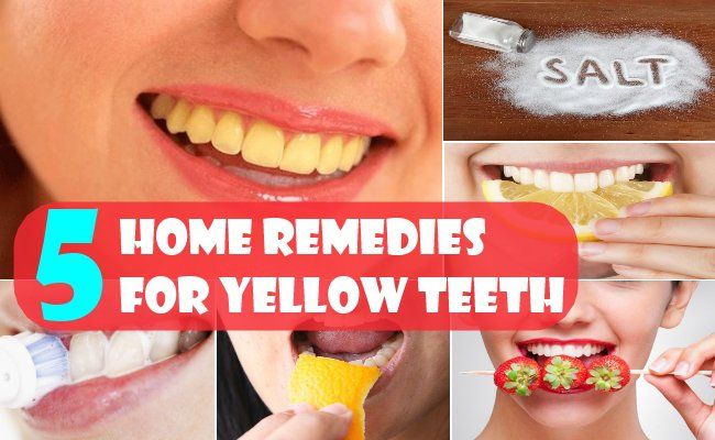 Remèdes à la maison pour les dents jaunes