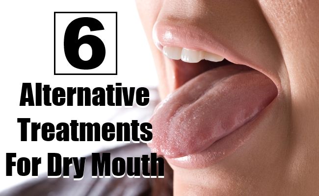 Traitements alternatifs pour Sécheresse de la bouche