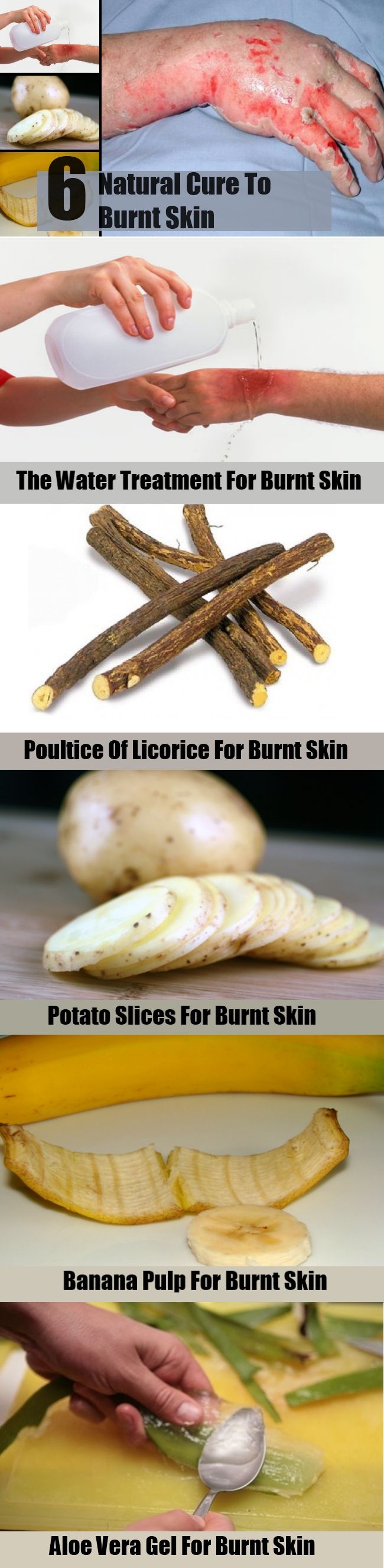 Remèdes naturels pour la peau Burnt