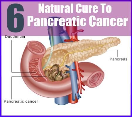 6 remède naturel pour le cancer du pancréas