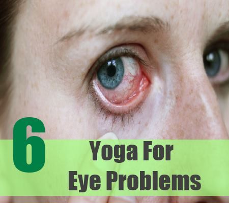 6 Yoga pour des problèmes des yeux
