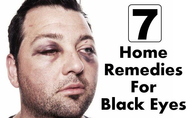 7 remèdes maison pour étonnants yeux noirs