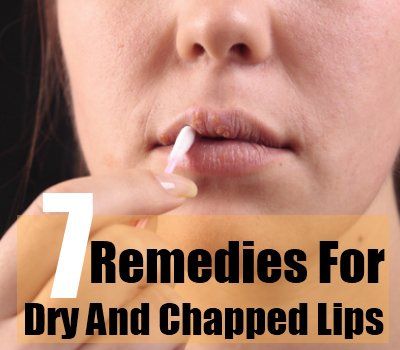 7 remèdes efficaces à domicile pour les lèvres sèches et gercées