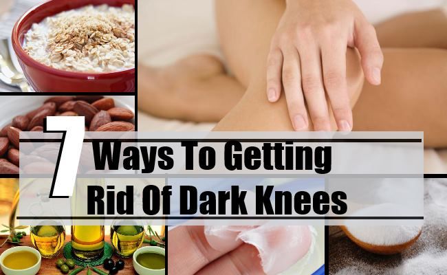 7 façons efficaces de se débarrasser de genoux sombres