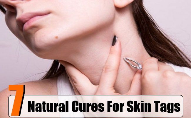 7 remèdes naturels pour les balises de la peau