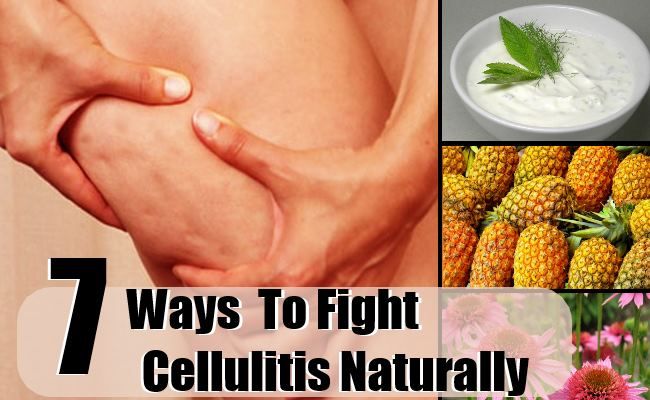 7 façons de lutter contre la cellulite naturellement