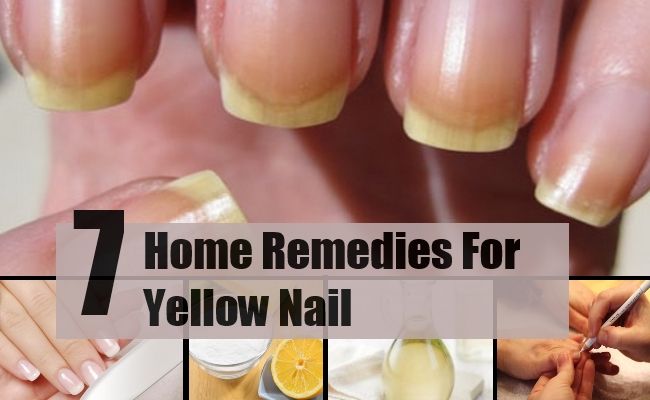 7 remèdes maison merveilleux pour ongles jaunes