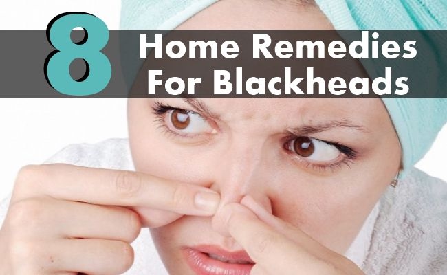 8 remèdes maison étonnants pour les points noirs