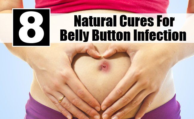 Natural Cures pour Belly Button Infection