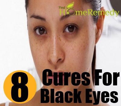 8 remèdes naturels efficaces pour les yeux noirs