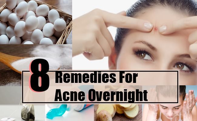 8 remèdes maison pour l'acné pendant la nuit