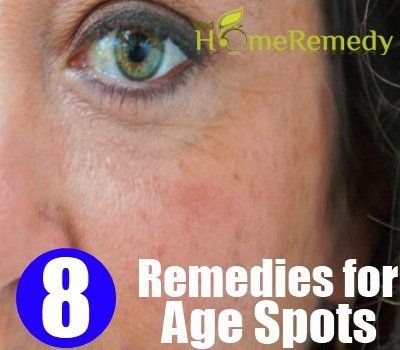 8 remèdes naturels pour les taches de vieillesse