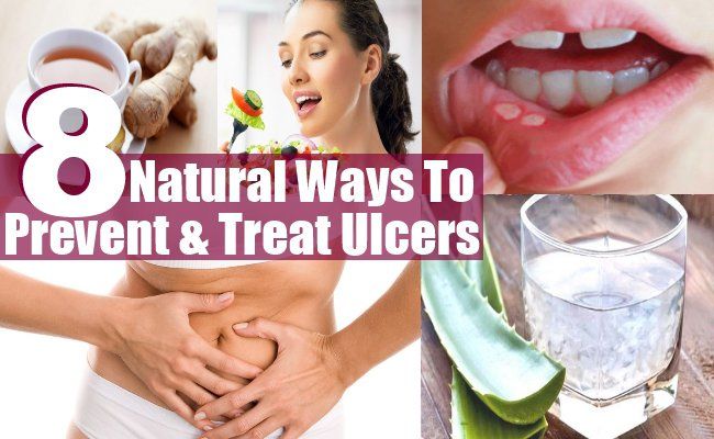 8 façons naturelles pour prévenir et traiter les ulcères