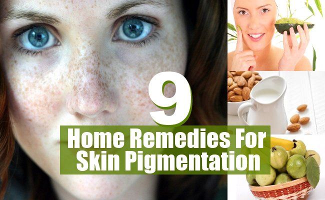 9 meilleurs remèdes efficaces à domicile pour la pigmentation de la peau