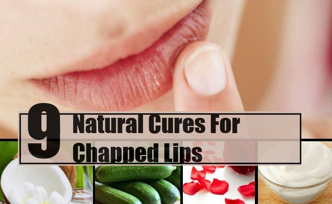 9 meilleurs remèdes naturels pour les lèvres gercées