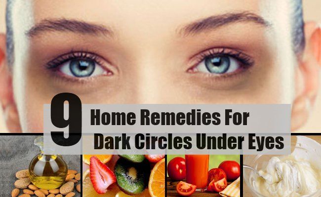 9 remèdes efficaces à domicile pour les cernes sous les yeux