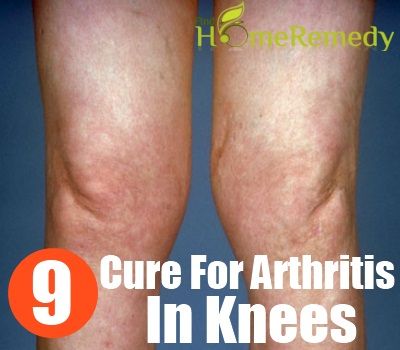 9 remède naturel pour l'arthrite dans les genoux