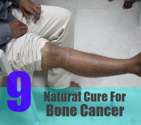 9 remède naturel pour le cancer des os