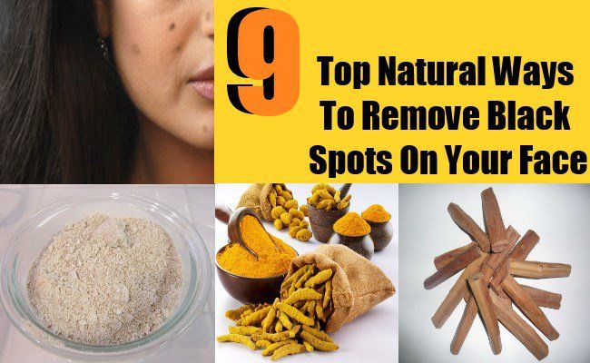 9 façons naturelles Top pour enlever les taches noires sur votre visage