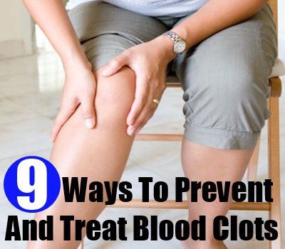 9 façons de prévenir et traiter les caillots sanguins