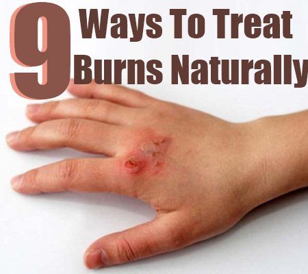 9 façons de traiter les brûlures naturellement
