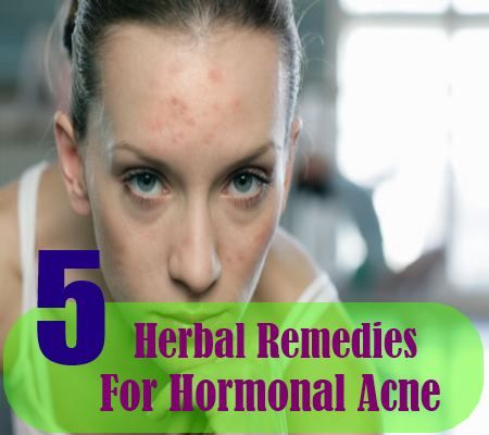 5 meilleurs remèdes pour l'acné hormonale