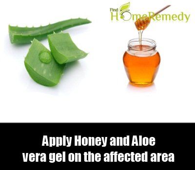 Aloe Vera And Honey
