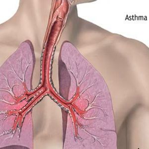 Remèdes à la maison de l'asthme Symptômes