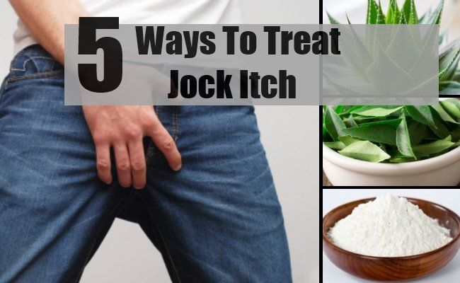 Jock Itch