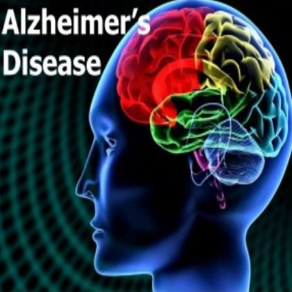Comment traiter la maladie d'Alzheimer