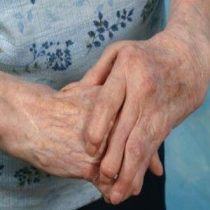 Comment traiter l'arthrite