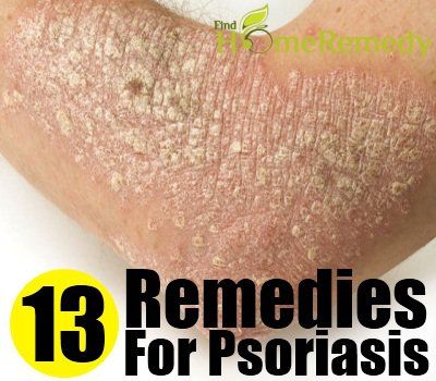 Les 13 meilleurs remèdes maison pour le psoriasis