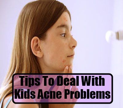 Conseils pour faire face aux problèmes d'acné enfants