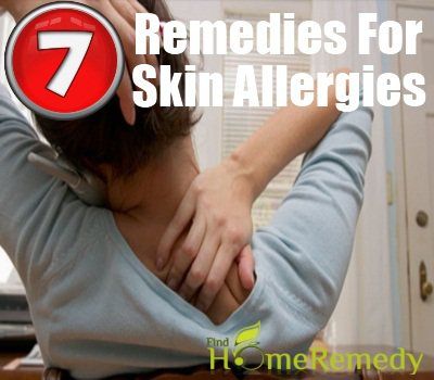 Conseils pour se débarrasser des allergies de la peau avec des remèdes maison