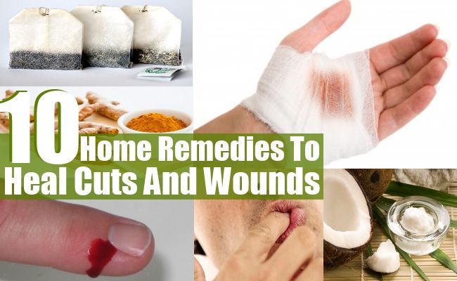 Top 10 des remèdes maison pour guérir les coupures et blessures