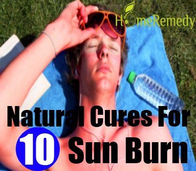 Top 10 des remèdes naturels pour la brûlure du soleil