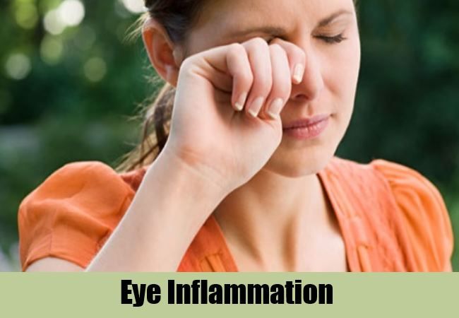 L'inflammation des yeux