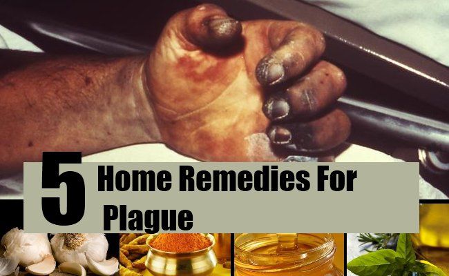 Top 5 des remèdes maison pour la peste