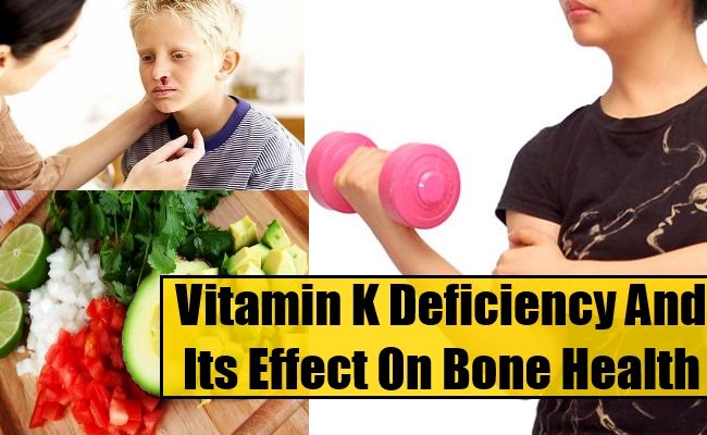 Carence en vitamine K et ses effets sur la santé des os