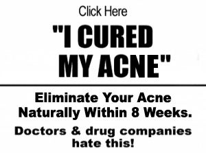 acné