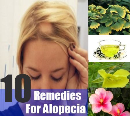 10 remèdes à base de plantes pour l'alopécie