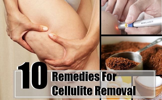 10 remèdes à la maison pour l'élimination de la cellulite