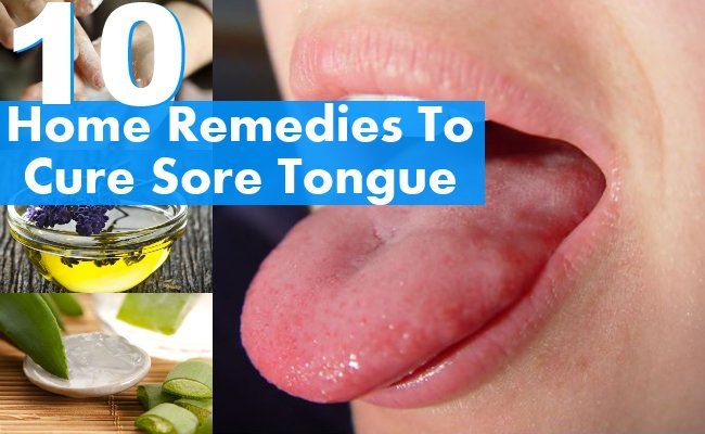 Remèdes pour guérir mal de la langue